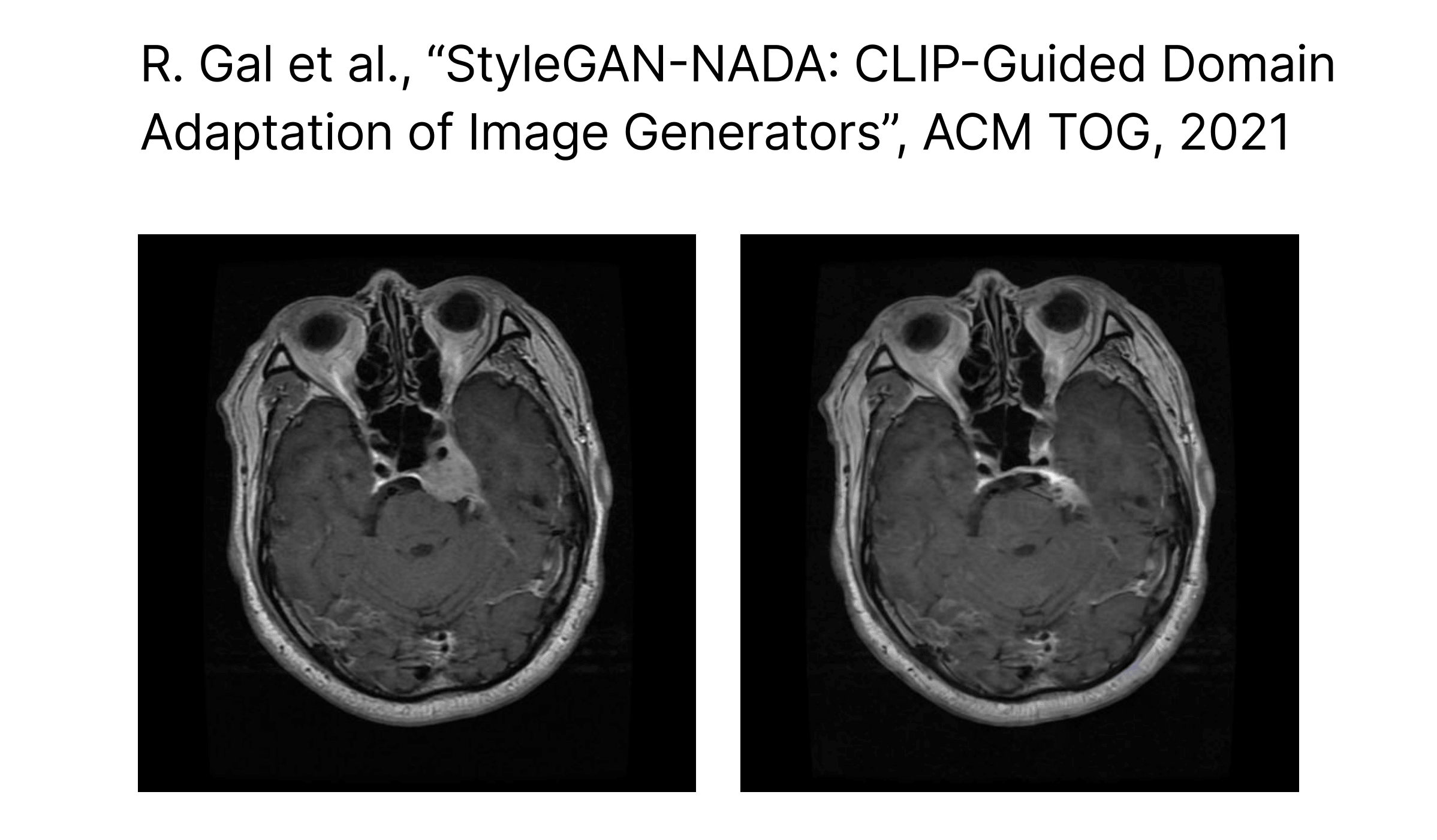 Medical AI and computer vision interest image